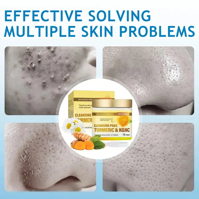 Kojic Acid and Turmeric Pads, Turmeric Kojic Acid Pads wth Natural Ingredients